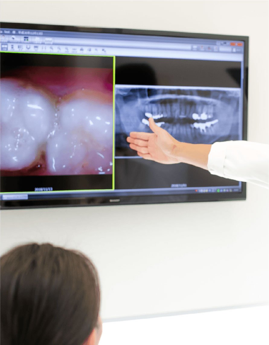 専門機器が充実多角的に診る歯科検査