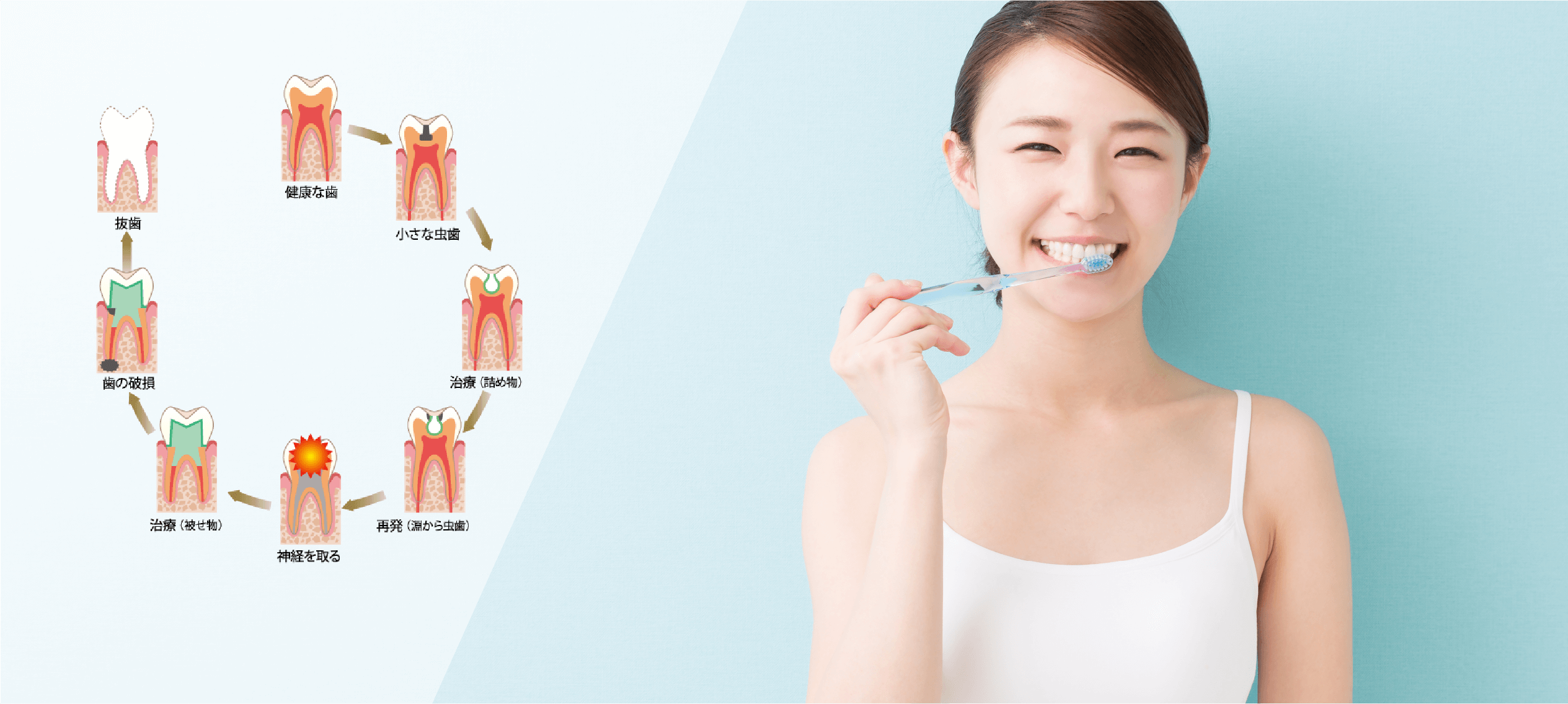 腔管理を徹底歯のサイクルを考えた治療を実践